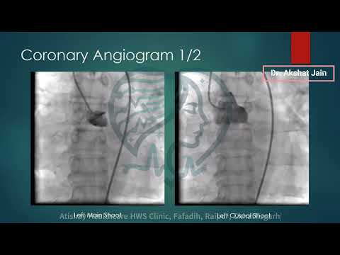 Acute MI with Left Main Occlusion with Shock and HF - Left Main PCI in Acute Setting - For Doctors