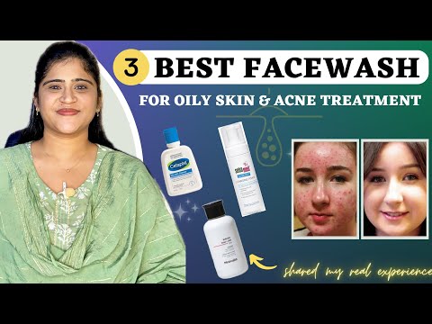 Oily & Acne prone skin : 3 Best Facewash | Dr. Arwa Bohra