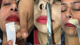 Upper lips and chin waxing by Rica wax#waxingtips#upperlipswaxing #ricawax@pummybeautyworld
