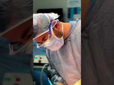 23 seconds from an operation…