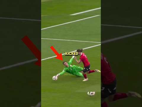 Goalkeeper Kicked In Head