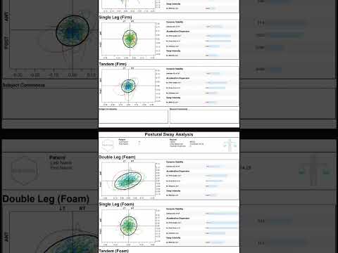 Postural Sway #shortsvideos #motioncapture