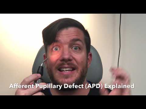 Afferent Pupillary Defect - APD Explained
