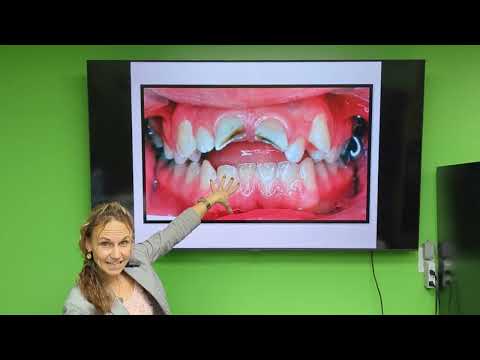 Dental Health Lecture by Dr. Karski