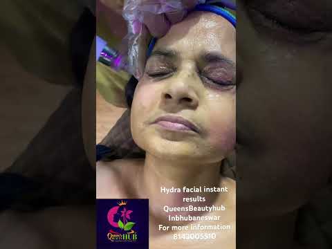 #hydra#hydrafacial#skincare#skinwhitening#darkspotsremove#blackheadremoval#brightenskin