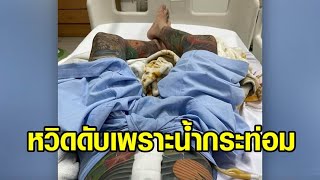 อุทาหรณ์! หนุ่มโพสต์เตือนสติ เลิกได้เลิก ‘น้ำกระท่อม’ หลังซดแทนน้ำ ทำลำไส้อุดตันเฉียดตาย