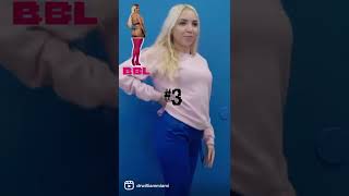 Who Had A BBL? 🤩🍑🤔 #drwilliam #shorts #bblresults