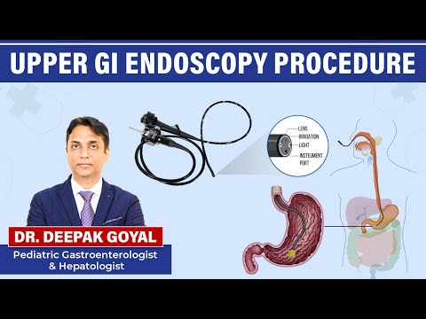 Endoscopy/ दूरबीन की जांच के बारें में जानकारी