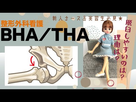 BHAとTHA脱臼しやすいのは？理由は？【整形外科看護】動画で勉強★#看護師#新人ナース