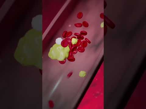 heart attack #3d #medicosphere #physiology #viral #shorts #medicos #medical #heart #anatomy #bio