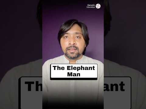 The Story of the Elephant Man