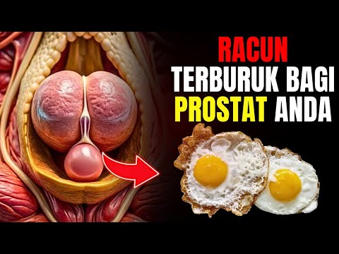 🔥 7 Makanan Berbahaya 🚫 yang Dapat Merusak Kesehatan Prostat Pria! ⚠️🥩🍔