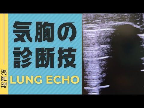 【超音波で一撃】研修医も！肺エコーで気胸診断も一撃！超音波片手に胸に当ててみよう