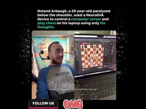 paralyzed person controls a computer cursor only  with the thoughts  #nuralinks #elonmusk #ai