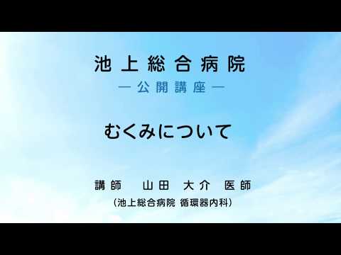 むくみについて 〜 ダイジェスト版〈池上総合病院 公開講座〉