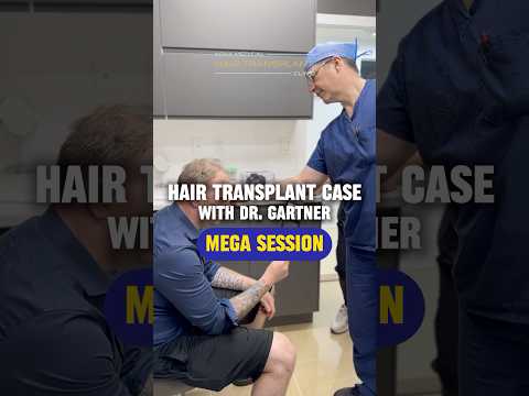 💪🏻Life-Changing Hair Transplant: Hear Our Patient’s Story / #fuenewjersey #hairtransplantcase