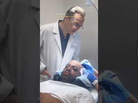 🔥Dr. Gartner’s FEINal Touch: Instant Results! / #hairtransplantdoctor #hairtransplantfue