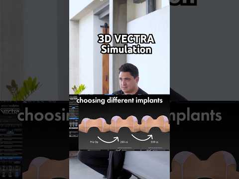 VECTRA 3D ✨ #simulation #vectra #plasticsurgery #plasticsurgeon