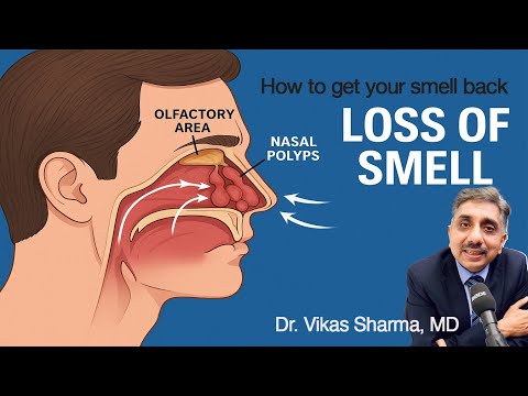 Get Your Smell Back Naturally – Nasal Polyps Treatment Guide