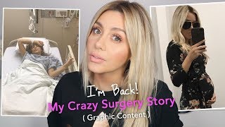 My Crazy Fibroid Surgery Story (Graphic Content)