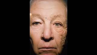UV damage face vs. neck, face ages differently