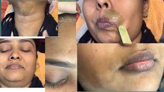 Forehead/Upper lips waxing tutorial/#wax #skincare #waxingtips #italwax