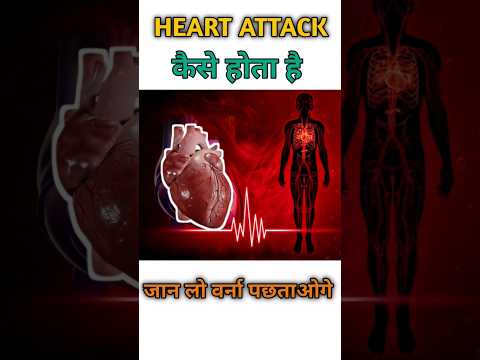 Heart attack symptoms|heart attack ke lakshan credit-@rajshamani #heartattack