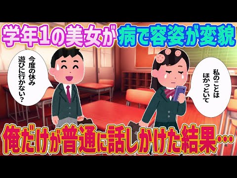 【2ch馴れ初め】学年1の美女が病で髪が抜け容姿が変貌→俺だけが普通に話しかけた結果…【ゆっくり解説】