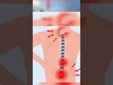 #Diseases of Leo Lagna #Singh Rashi #leo ascendant disease #simha lagna #diseases