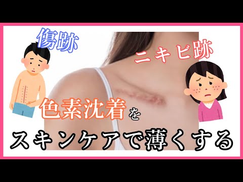 【ニキビ跡、傷跡】色素沈着を薄くする方法📝