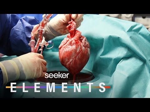 Inside the First Ever Pig-to-Human Heart Transplant