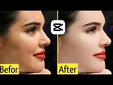 Smooth skin video editing 🙂|| how to remove pimple