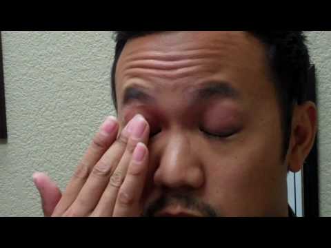 Los Gatos Eye Care-Instructions for eyelid cleansers