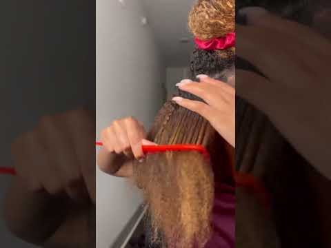 Am I going bald?? 😩 #hairloss #braids #naturalhair #protectivestyles