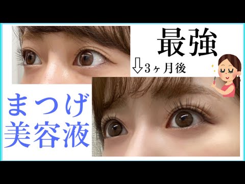 【最強のまつげ美容液】これ以上のものがあったら教えてほしい！