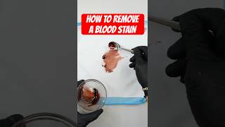 Blood Stain Removal Guide #stain #laundry #bloodstain