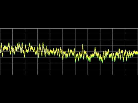 Herpes New 2 - Rife Frequencies