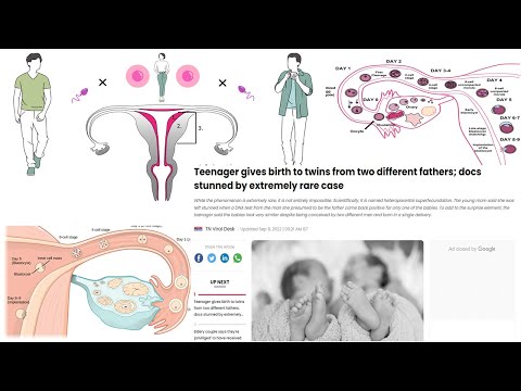 Heteroparental Superfecundation || Twins from two different fathers ||