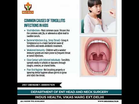 COMMON CAUSES OF TONSILLITIS INFECTIONS IN KIDS