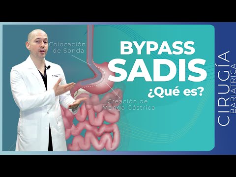 BYPASS SADIS ¿Qué es? ¿Cómo funciona? | Cirugía