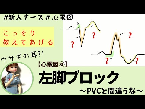 【心電図読み方⑥】左脚ブロック！PVC（心室期外収縮）と間違うなよん★#新人ナース#看護師#勉強