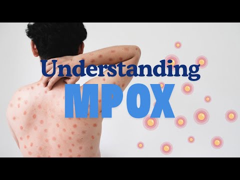 Understanding Mpox - Origins, Symptoms, and How to Stay Safe