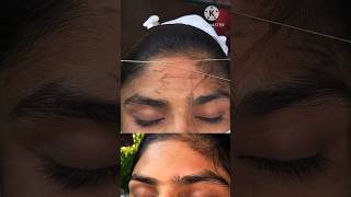 forehead threading | eyebrow forehead