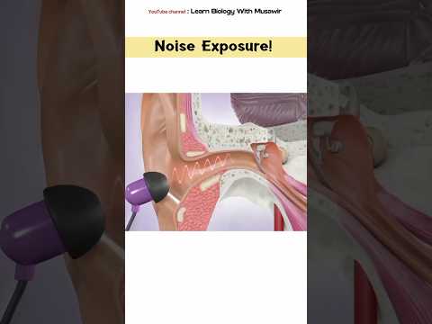 Noise Exposure | 3D animation