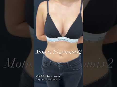 爆乳目指せます🩷Motiva Ergonomix2 #美容外科 #美容整形 #豊胸 #美容  #新宿 #バストアップ