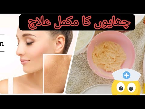 pigmentation &acne scars treatment at home/one month challenge/brides skin care/چھایوں کا مکمل علاج