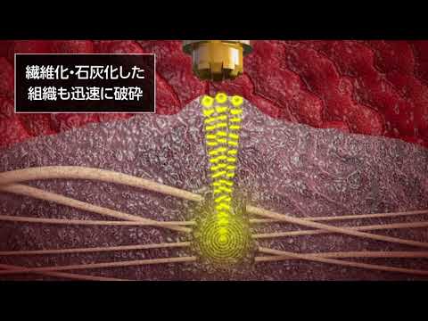 『インパクトムービー®』インテグラジャパン様「CusaClarity」2018年