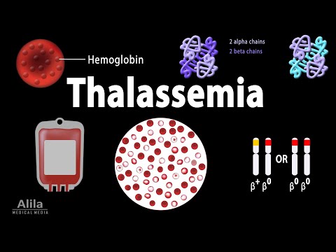 Thalassemia: Alpha & Beta-Thalassemias, Genetics, Pathophysiology, Diagnosis & Treatment, Animation