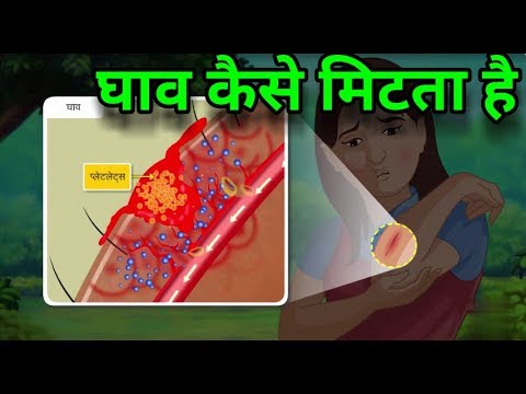 चोट कैसे ठीक होती है? | how your body heals itself?
