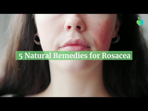 5 Natural Remedies for Rosacea